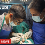 प्राइवेट अस्पताल मांग रहे थे मोटी रकम, गढ़वा सदर अस्पताल के ‘देवदूत’ ने मुफ्त में दी नई जिंदगी!