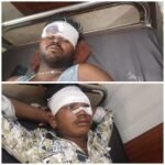 मोटरसाइकिल दुर्घटना में साला-जीजा गंभीर घायल, सदर अस्पताल में इलाज जारी